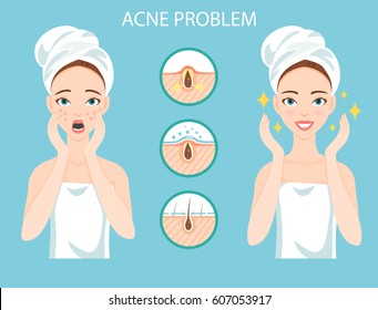 Troubled teen with female facial skin problem needs to care about: infographic of acne disease and stages of it's treatment.