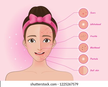 Troubled woman and set of most common female facial skin problems needs to care about: acne ,Freckle and dull skin