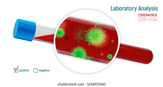 Tube with blood under microscope. Vector graphics of laboratory analysis of Coronavirus 2019-nCov.
