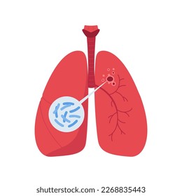 Tuberculosis disease concept. Vector flat healthcare illustration. Red infected lung with bacteria isolated on white background. Design element for health care, education, pulmonology