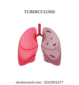 Tuberculosis disease vector, illustration design for medical 