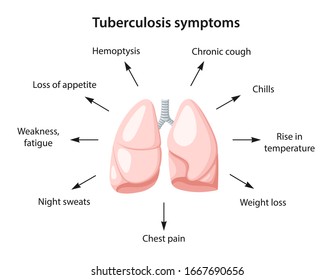 Tuberculosis symptoms as text. Image of human lungs. Vector illustration in flat style isolated over white background.