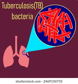 La tuberculosis (TB) es una enfermedad infecciosa que afecta con mayor frecuencia a los pulmones. La tuberculosis está causada por un tipo de bacteria. Se propaga por el aire cuando las personas infectadas tosen, estornudan o escupen.