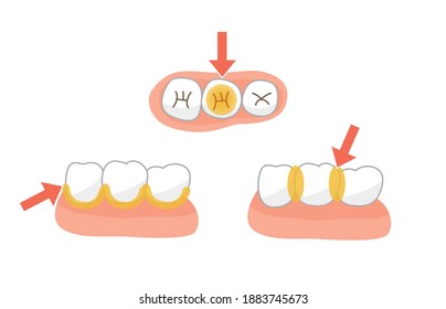 Tuft brush toothpaste leftover food