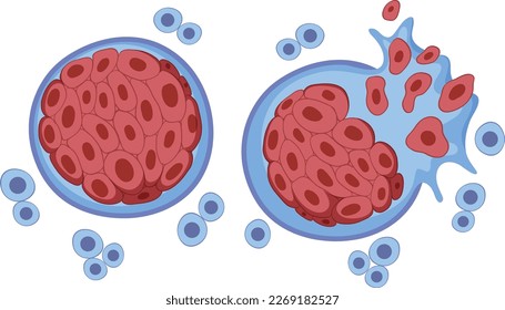 Tumor cell and cancer development illustration