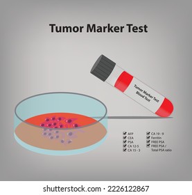 Tumor Marker Test, Vector And Illustration