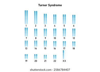 Turner Syndrome Science Design. Vector Illustration.