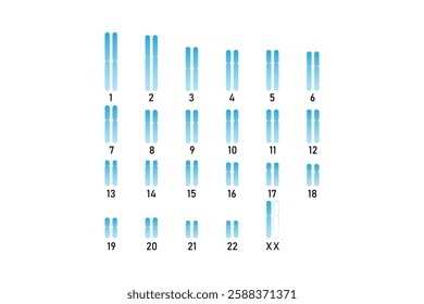 Turner Syndrome Science Design. Vector Illustration.