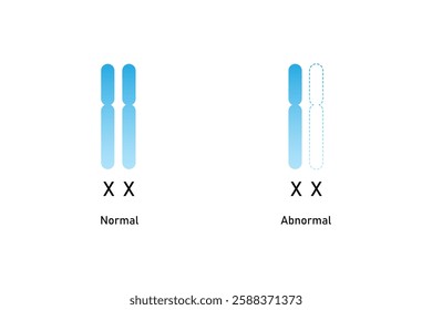 Turner Syndrome Science Design. Vector Illustration.