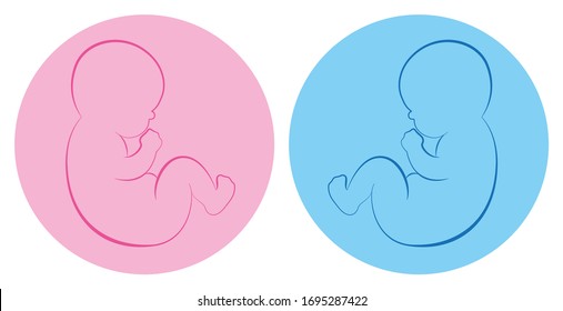 Twins pictogram. Baby boy and baby girl on blue and pink round background. Isolated outline vector illustration.
