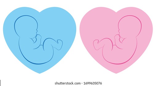 Twins pictogram. Baby boy and baby girl on blue and pink heart framed background. Isolated outline vector illustration.
