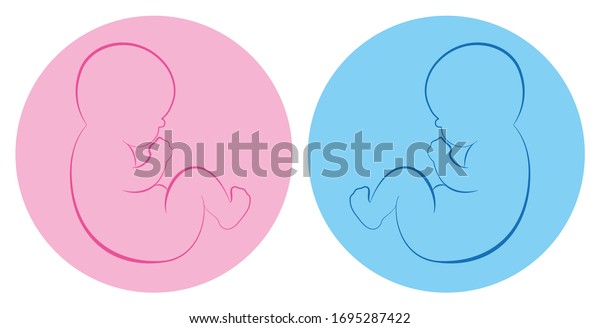 双子の絵文字 青とピンクの丸い背景に赤ちゃんの男の子と女の子 輪郭のベクターイラスト のベクター画像素材 ロイヤリティフリー