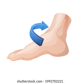 Twisted Foot- Ankle Sprain - Illustration as EPS 10 File