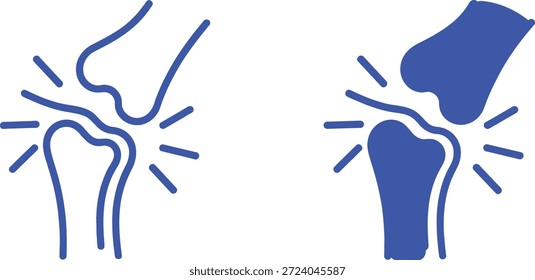 Dos articulaciones azules de la rodilla, una delineaba un dolor óseo lleno