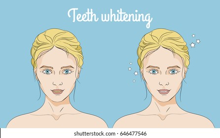 Two faces of a woman before and after teeth whitening on blue background
