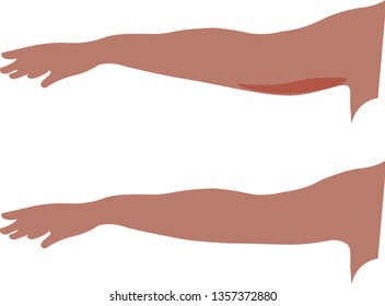 Two female hands, one with loose skin, the other toned. White background. Vector.
