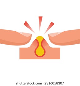 Two fingers squeeze a pimple. Acne icon. Pimple on the skin. Diseases on the skin. Vector illustration flat design. Isolated on white background.