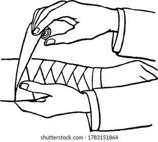 Dos manos que unen una venda en un brazo con , dibujo de línea vintage o ilustración de grabado.
