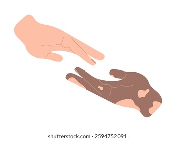 Two hands are stretching to each other. Concept of help, diversity, friendship sign. World vitiligo day. Lend a helping hand. Treatment symbol. Hand drawn vector illustration in flat style