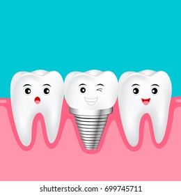 Two healthy teeth and implant tooth between. Funny cartoon character design. Human tooth implant concept, Illustration.