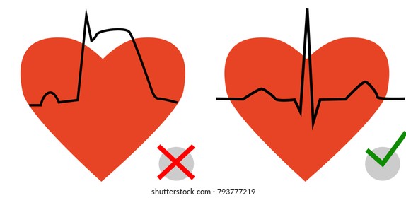 two hearts with a cardiogram, a comparison of cardiograms - the norm and myocardial infarction