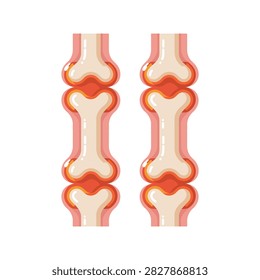 Two human bone joints side by side showing skeletal structure and cartilage for orthopedic medical education and anatomy reference