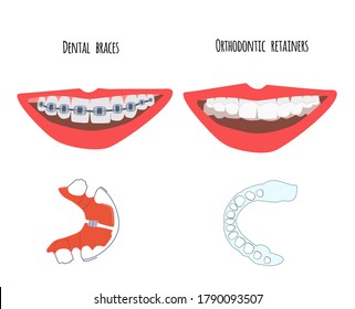 Two human mouth with dental braces and orthodontic transparent retainers on teeth. Choice between them. Oral care,bite correction. Beautiful straight  smile. Vector flat illustration for clinic