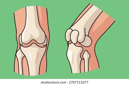 Dos ilustraciones de una articulación de rodilla humana, de frente y de lado.