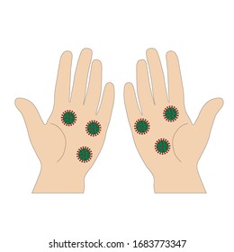 Two palms with coronavirus.Method of transmission of coronavirus.Pandemic.Vector illustration.Hands close up