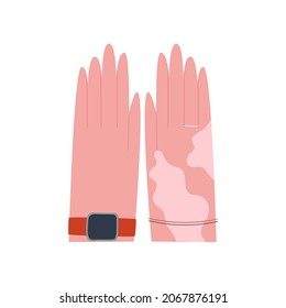 Dos palmas de un hombre de fondo blanco. Una palmera está cubierta de manchas de vitiligo. El concepto de aceptar el propio cuerpo. Ilustración vectorial plana