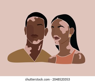 Two people with vitiligo of different nationalities. World vitiligo day concept