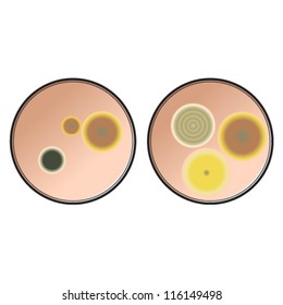 Two petri dishes with microbes/fungi/mould growing on them.