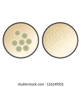 Two petri dishes with microbes/fungi/mould growing on them.