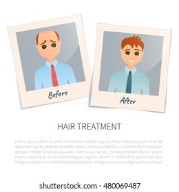 Two photographs of a man before and after hair treatment and transplantation. Male alopecia design template. Baldness medical concept. Vector illustration.