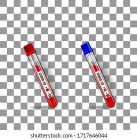 
two realistic vector tubes on a checkered background, filled with blood, with stickers for the test results for covid-19 (one positive, one negative)