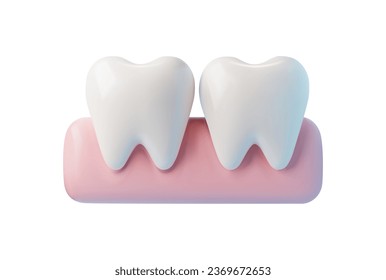 Two teeth in the gum, 3d vector illustration, isolated on white background. Realistic white dental, medicine and health concept design element. Icon or clipart of tooth.