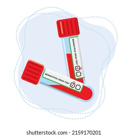 Two test tubes for a blood test to determine the monkeypox virus.Blood sample for research in the laboratory.