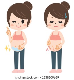 Two types of pregnant women suffering from pregnancy line