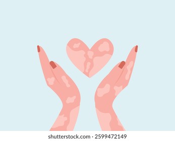 Two vitiligo hands with suffering from leprosy disease holding heart show care and support. vector illustration