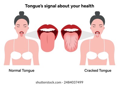 Two woman and Cracked tongue problem 