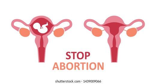 Two wombs. One with a child, the other without a child. Stop abortion sign. Flat vector on white background