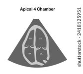 The Two-Dimensional Echocardiographic Examination.  Echocardiographic view: Apical 4 chamber