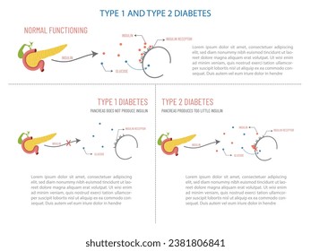 Diabetes tipo 1 y tipo 2, cómo ocurre.
Procesar desde el páncreas hasta la captación o no de insulina por los receptores.