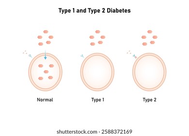 Type 1 and Type 2 Diabetes Science Design. Vector Illustration.