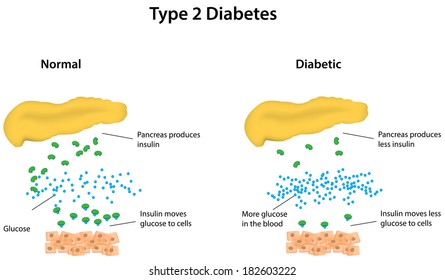 Diabetes Symptoms Cure Prevention, About Diabetes, Diabetes and Cure, Videos on Diabetes, What is cure for Diabetes, World Diabetes Day
