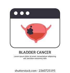 Type of cancer bladder concept. Disease of iternal organ. Medical infographics, biology and anatomy. Template, layout and mock up. Cartoon flat vector illustration isolated on white background