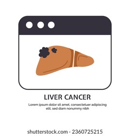 Type of cancer liver concept. Disease of iternal organ. Healthcare and medicine. Medical infographic and educational material. Cartoon flat vector illustration isolated on white background