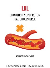 Tipo de colesterol en los vasos sanguíneos humanos. Arteria estrecha para explicar las enfermedades. Lipoproteína LDL de baja densidad . Ilustración vectorial