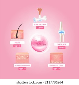 Type of collagen. The five most common types of collagen protein. Main protein created connective tissues, cartilages, bones, nails, skin and hair. Medical and science concept. Vector EPS10.