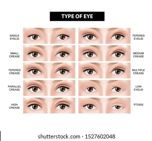 Type Of Eyelid Crease Vector Illustration 